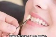 淡黃色是牙醫(yī)公認(rèn)的健康色號(hào)，牙醫(yī)專家：健康牙齒的顏色并非純白